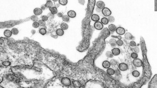 Is the cruise ship hantavirus outbreak getting the right amount of attention?