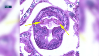 Does this new parasite in the Pacific Northwest give you worries about your pet?